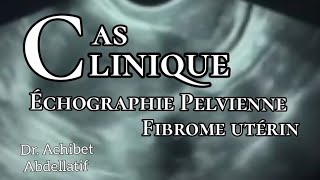 Dr Achibet  formation  Échographie pelvienne  fibrome utérin [upl. by Haizek287]