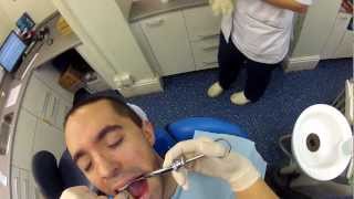 GoPro Wisdom Tooth Removal  2013 [upl. by Llehcram597]