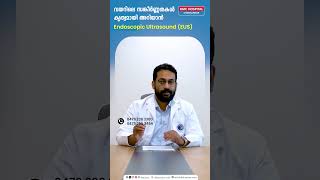 വയറിലെ സങ്കീർണ്ണതകൾ കൃത്യമായി അറിയാൻ Endoscopic Ultrasound EUS  Dr Anup S Nair [upl. by Vanessa]