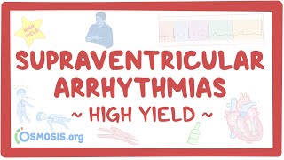 Supraventricular arrhythmias Pathology review [upl. by Ahsats]