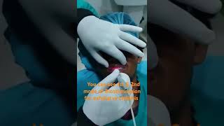 Mode of Laser treatment for exfoliatve cheilitis 1st amp 2nd mode [upl. by Henryk]