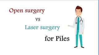 Open surgery vs Laser Surgery for Piles Treatment in Bangalore  Dr Manas Tripathy [upl. by Aerdnaxela]