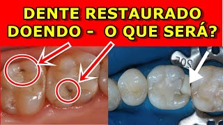 Dente Restaurado Doendo  O que pode ser O que fazer [upl. by Salesin]