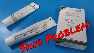 Skin Problem alergy Solution [upl. by Lynn]