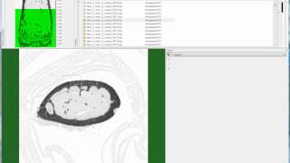 Bruker microCT tutorial Setting the cortical VOI for the mouse femur [upl. by Gibun873]