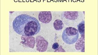 LEUCOCITOS NORMALES Y PATOLÓGICOSwmv [upl. by Craggie]