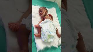 little preterm baby viralvedio nicu newborn babyboy [upl. by Jedlicka169]