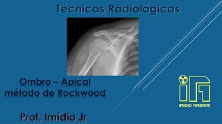 Ombro Apical  AP Axial sem rotação  método de Rockwood [upl. by Noach508]