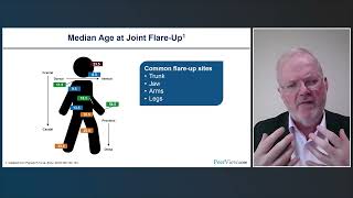 Can YOU Avoid Iatrogenic Harm Understanding and Identifying Fibrodysplasia Ossificans Progressiva [upl. by Hanikahs]