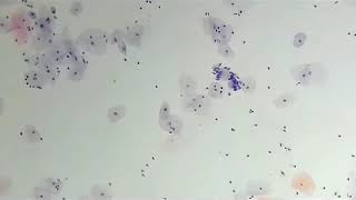 Patterns of normal endocervical cells in cervical cytology you must know [upl. by Aidnac710]