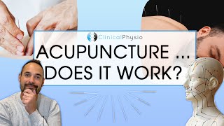 Does Acupuncture Work in Physiotherapy  Expert Physio Reviews the Evidence [upl. by Amaris]