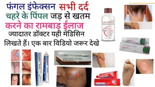 Best skin cream ointment  Antifungal creamAntibiotic cream emergency medicine drug [upl. by Malas]