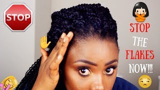 HOW TO PREVENT GEL FROM FLAKING ON NATURAL HAIR  TIPS AND TRICKS [upl. by Bollinger]