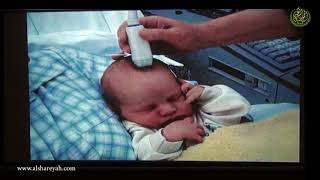 Neonatal Cranial ultrasound  القطاع الطبي بالجمعية الشرعية الرئيسية [upl. by Enar]