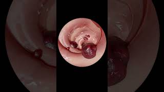 The ULTIMATE Guide to Gastrointestinal Endoscopy  Step by Step Tutorial [upl. by Elicia4]