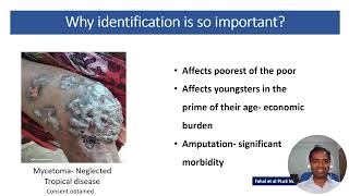 Importance of speciation in medical mycology  Dr Vinaykumar Halluru  MycoAsia [upl. by Nagey]