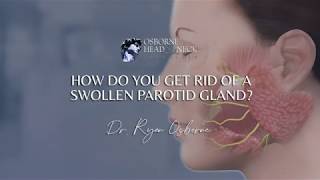 How do you get rid of a swollen parotid gland [upl. by Annoit]