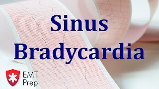 Sinus Bradycardia ECG  EMTprepcom [upl. by Ofilia]