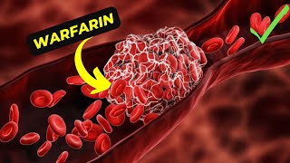 The Ultimate Guide to Understanding Warfarin Its Benefits and side effects [upl. by Llertnauq]