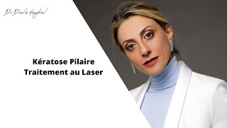 🔴Kératose pilaire Traitement au Laser [upl. by Ylac]