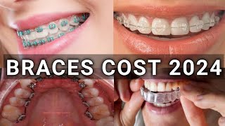 Braces Type amp Treatment Cost 2024  Metal vs Ceramic vs Lingual vs Invisalign Braces  Latest [upl. by Aimar]