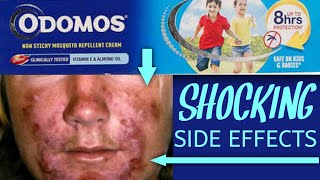 Odomos For Skin And Mosquito 🦟 Odomos Cream Uses In Hindi Odomos Cream Review Odomos In 2022 [upl. by Aihsilat893]