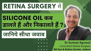 रेटिना SURGERY में SILICONE OIL डाला है तो निकालेंगे कब [upl. by Llednik]