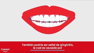 Encías sangrantes y los signos de la gingivitis  Colgate® [upl. by Greenland]