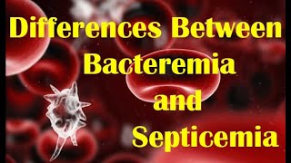 bacterial infection of blood complication of inflammation [upl. by Rora730]