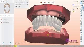 Digital Full Dentures Design Colour Scan [upl. by Gaelan]