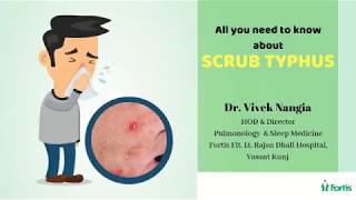 All about SCRUB TYPHUS  Dr Vivek Nangia [upl. by Buyers]