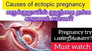 Causes of ectopic pregnancy in tamiltubal pregnancy risk factorsectopicpregnancy [upl. by Helbonnah]