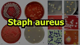 Staphylococcus aureus [upl. by Odilo]