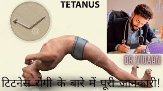 Tetanus Symptoms Treatment  Why Should You Take Tetanus Vaccine  Tetanus In Baby Patient Live IPD [upl. by Lucie304]