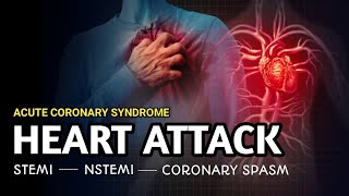 Types of Heart Attack  STEMI NSTEMI Unstable angina  Acute Coronary Syndrome [upl. by Kasey965]