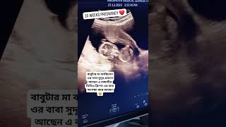 16 Weeks Pregnancy Ultrasonogram  ১৬ সপ্তাহের আলট্রাসোনোগ্রাম কেমন হয় ultrasound pregnancyscan [upl. by Wilmette545]