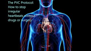 THE PVC PROTOCOL How to treat irregular heartbeats without drugs or surgery [upl. by Aohsoj]