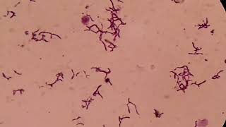 Branching Gram positive Rods Microscopy at various magnifications [upl. by Rogerio]