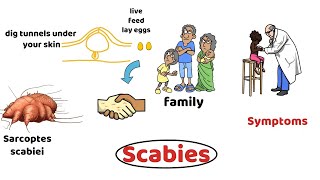 Scrabies Diagnosis Treatment Prevention [upl. by Earezed]