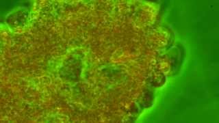 Feeding Amoeba and Food Vacuole Blepharisma [upl. by Weidar820]