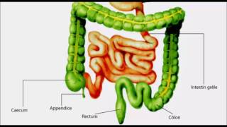 Appendicite inflammation de l’appendice [upl. by Shiekh]