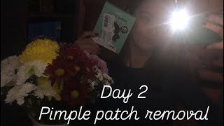 PIMPLE PATCH REMOVAL 2 [upl. by Callum]