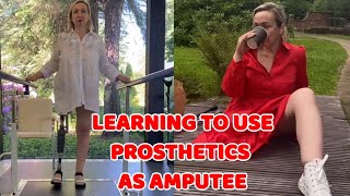 Amputee woman  adaptive prosthetic leg user  learning how to use [upl. by Drusi]