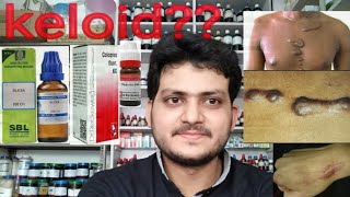 KeloidHomeopathic medicine for keloid explain [upl. by Noemis]