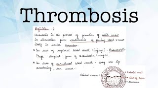 THROMBOSIS PATHOLOGY [upl. by Dian]