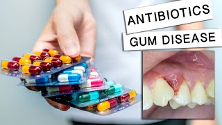 Can Antibiotics Cure Gum Disease [upl. by Dennet]