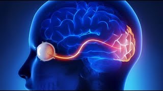 Optic Neuritis [upl. by Woolley]