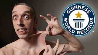 The Stretchiest Skin In The World  Guinness World Records [upl. by Rubinstein]