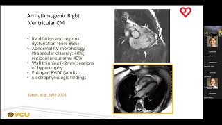 Assessment of Cardiomyopathy with Magnetic Resonance Imaging  Greg Hundley MD [upl. by Thatcher]