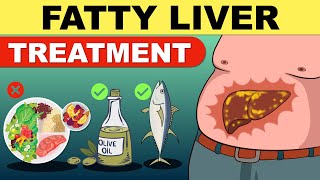 Fatty Liver Treatment  Fatty Liver Diet  Liver Detox  Fatty Liver  Fatty Liver Symptoms [upl. by Schiff]